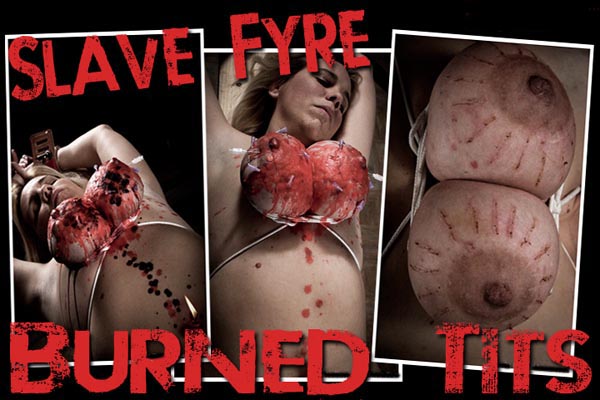 Fyre Burned Tits