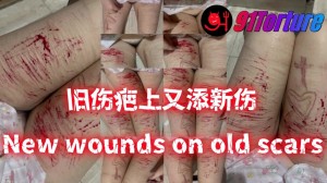 New wounds on old scars