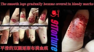 The smooth legs gradually became covered in bloody marks