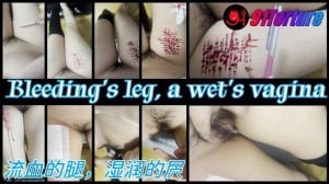 Bleeding's leg, a wet's vagina