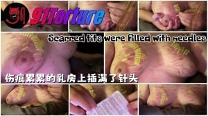 Scarred tits were filled with needles